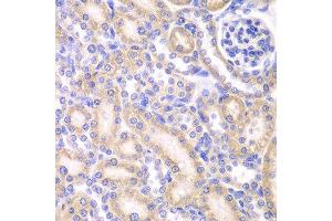 Immunohistochemistry (IHC) image for anti-Adenylate Kinase 4 (AK4) (AA 1-223) antibody (ABIN3022790)