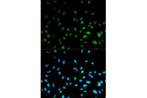 Immunofluorescence analysis of MCF-7 cells using HDAC3 antibody (ABIN5971166). (HDAC3 anticorps)