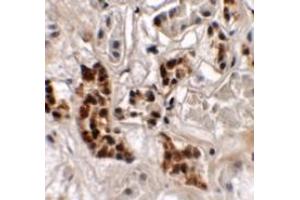 Immunohistochemistry (IHC) image for anti-SPRY Domain Containing 4 (SPRYD4) (Middle Region) antibody (ABIN1031106) (SPRYD4 anticorps  (Middle Region))