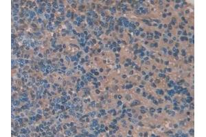 Detection of CA2 in Rat Spleen Tissue using Polyclonal Antibody to Carbonic Anhydrase II (CA2)