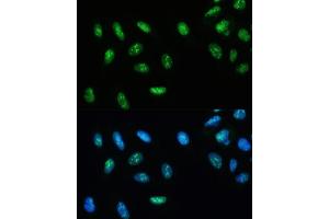 Immunofluorescence analysis of U-2 OS cells using DHX9/RNA Helicase Aantibody (ABIN7265748) at dilution of 1:100. (DHX9 anticorps)