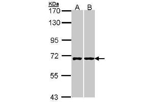 WB Image Sample (30 ug of whole cell lysate) A: A431 , B: Hela 7.