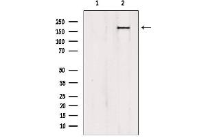 Western blot analysis of extracts from HepG2, using PTPN23 antibody. (PTPN23 anticorps  (C-Term))