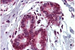 Breast, Human: Formalin-Fixed, Paraffin-Embedded (FFPE) (THRSP anticorps)