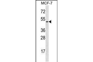 Western blot analysis in MCF-7 cell line lysates (35ug/lane). (Ladinin 1 anticorps  (N-Term))
