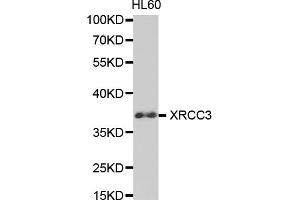 Western blot analysis of extracts of HL-60 cells, using XRCC3 antibody (ABIN5971161) at 1/1000 dilution. (XRCC3 anticorps)