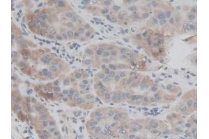Used in DAB staining on fromalin fixed paraffin- embedded kidney tissue (FAM132A anticorps  (AA 92-241))