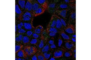 Immunofluorescence (IF) image for anti-Tumor Necrosis Factor Receptor Superfamily, Member 1B (TNFRSF1B) antibody (Biotin) (ABIN2478302)
