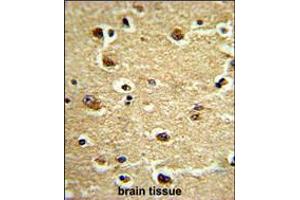 Formalin-fixed and paraffin-embedded human brain tissue reacted with CROT Antibody (N-term), which was peroxidase-conjugated to the secondary antibody, followed by DAB staining. (CROT anticorps  (N-Term))