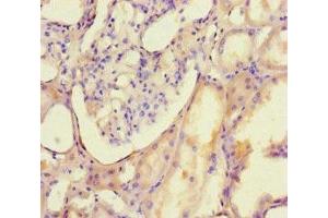 Immunohistochemistry of paraffin-embedded human kidney tissue using ABIN7150116 at dilution of 1:100 (DNMT3B anticorps  (AA 1-100))