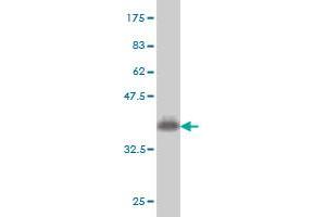 Western Blot detection against Immunogen (36. (COQ8A anticorps  (AA 1-100))