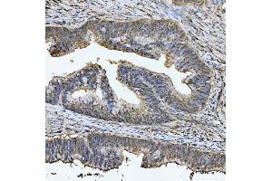 IHC analysis of TIGD1 using anti-TIGD1 antibody (ABIN7602407).