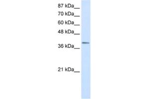 Western Blotting (WB) image for anti-LIM Homeobox Transcription Factor 1, alpha (LMX1A) antibody (ABIN2460347) (LMX1A anticorps)