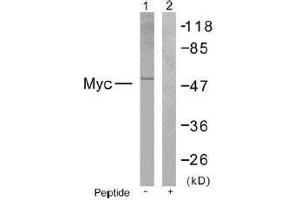 Image no. 1 for anti-Myc Proto-Oncogene protein (MYC) (Ser373) antibody (ABIN197159) (c-MYC anticorps  (Ser373))