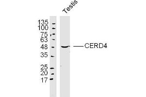 Mouse testis lysates probed with CERD4 Polyclonal Antibody, Unconjugated  at 1:300 dilution and 4˚C overnight incubation.