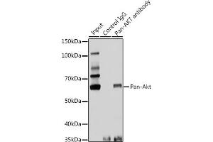 Immunoprecipitation analysis of 25 μg extracts of Rat brain cells using 3 μg Pan-Akt antibody (ABIN7265520). (AKT 1/2/3 anticorps)