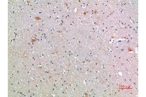 Immunohistochemical analysis of paraffin-embedded human-brain, antibody was diluted at 1:200