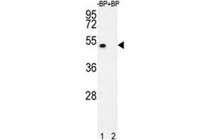 Western blot analysis of E2F1 antibody pre-incubated without (lane 1) and with (2) blocking peptide in 293T lysate. (E2F1 anticorps  (AA 342-371))