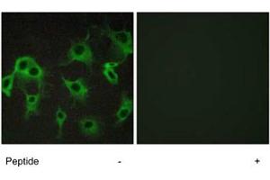 Immunofluorescence analysis of COS-7 cells, using ADRB2 polyclonal antibody . (beta 2 Adrenergic Receptor anticorps)