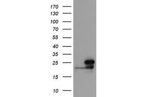 Image no. 1 for anti-NADH Dehydrogenase (Ubiquinone) 1 beta Subcomplex, 10, 22kDa (NDUFB10) antibody (ABIN1499671) (NDUFB10 anticorps)