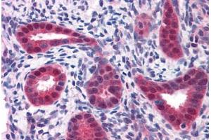 Human Uterus: Formalin-Fixed, Paraffin-Embedded (FFPE)