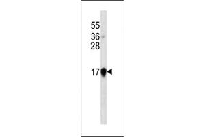 Interferon-alpha western blot analysis in IFN cell line lysates (35 μg/lane). (IFNA anticorps)