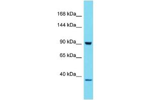 Host: Rabbit Target Name: HKDC1 Sample Type: 293T Whole Cell lysates Antibody Dilution: 1. (HKDC1 anticorps  (C-Term))