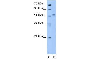 ZP4 antibody used at 0. (ZP4 anticorps  (N-Term))