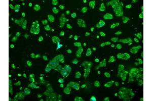 Anti-PRL mouse monoclonal antibody (ABIN2453520) immunofluorescent staining of COS7 cells transiently transfected by pCMV6-ENTRY PRL (RC205627). (Prolactin anticorps)