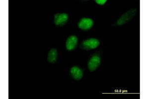 Immunofluorescence of purified MaxPab antibody to EED on HeLa cell.