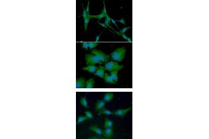 ICC/IF analysis of CTSS in U87MG cells line, stained with DAPI (Blue) for nucleus staining and monoclonal anti-human CTSS antibody (1:100) with goat anti-mouse IgG-Alexa fluor 488 conjugate (Green).