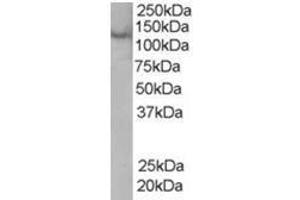 Image no. 1 for anti-Zinc Finger, FYVE Domain Containing 20 (ZFYVE20) (C-Term) antibody (ABIN374348) (Rabenosyn 5 anticorps  (C-Term))