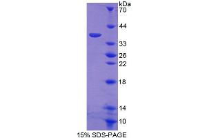 SDS-PAGE analysis of Human ERLIN2 Protein. (ERLIN2 Protéine)