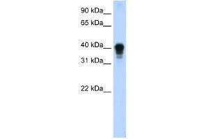 WB Suggested Anti-TIA1 Antibody Titration:  0. (TIA1 anticorps  (C-Term))