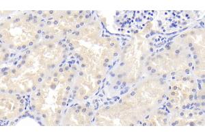 Detection of PDPK1 in Human Kidney Tissue using Polyclonal Antibody to Phosphoinositide Dependent Protein Kinase 1 (PDPK1)