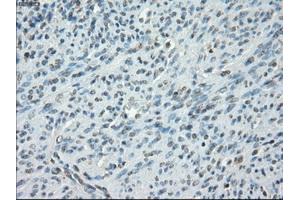 Immunohistochemical staining of paraffin-embedded colon tissue using anti-PRKAR1Amouse monoclonal antibody. (PRKAR1A anticorps)
