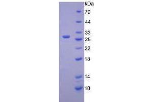 Image no. 1 for Hexosaminidase A (HEXA) (AA 319-528) (Active) protein (His tag) (ABIN6239906) (Hexosaminidase A Protein (HEXA) (AA 319-528) (His tag))