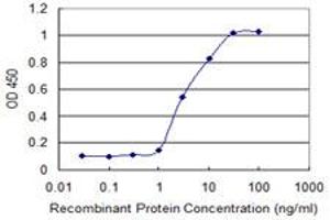 Detection limit for recombinant GST tagged FGFR1OP is 0. (FGFR1OP anticorps  (AA 1-379))