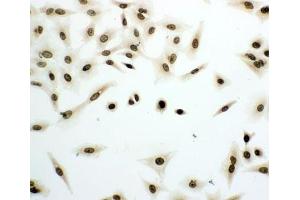 ICC testing of A549 cells