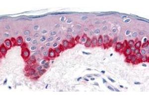 Immunohistochemistry of Apaf1 in human skin tissue with Apaf1 antibody at 20 μg/ml.