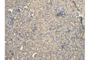 DAB staining on IHC-P; Samples: Mouse Kidney Tissue (BNP anticorps  (AA 77-121))
