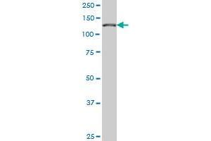 CAND1 monoclonal antibody (M02), clone 5F2 Western Blot analysis of CAND1 expression in Hela S3 NE . (CAND1 anticorps  (AA 1-100))