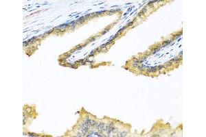 Immunohistochemistry of paraffin-embedded Human prostate using PENK Polyclonal Antibody at dilution of 1:100 (40x lens). (Enkephalin anticorps)