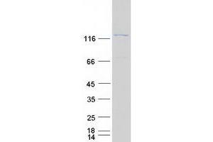 Validation with Western Blot