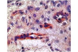 KDR in endothelial cells in blood vessels in placenta was detected using HRP/AEC red color stain.