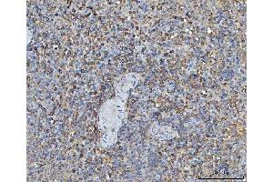 IHC analysis of TRMT61B using anti-TRMT61B antibody (ABIN7602334). (TRMT61B anticorps  (AA 7-477))