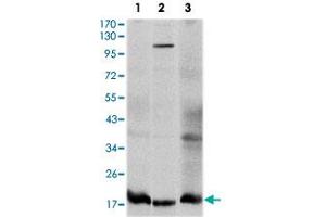 Western blot analysis using UBE2I monoclonal antobody, clone 1B10  against HeLa (1), HepG2 (2), and COS-7 (3) cell lysate. (UBE2I anticorps)