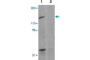 Western blot analysis of SYNPO2 in human skeletal muscle tissue lysate with SYNPO2 polyclonal antibody  at 1 ug/mL in (1) the absence and (2) the presence of blocking peptide. (SYNPO2 anticorps  (N-Term))