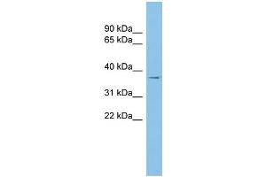 WB Suggested Anti-RALY Antibody Titration: 0. (Raly anticorps  (Middle Region))