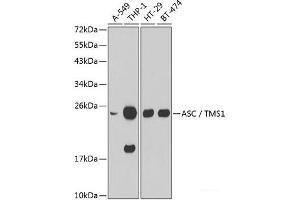 Western blot analysis of extracts of various cell lines using ASC / TMS1 Polyclonal Antibody. (PYCARD anticorps)